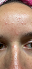 vor